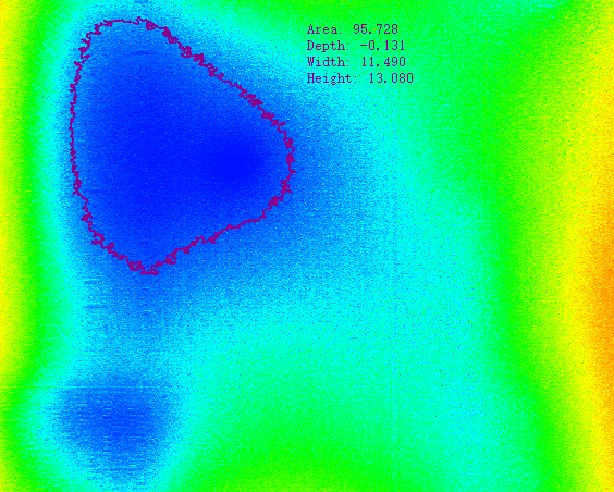 Chip Appearance Defect Detection with SinceVision 3D Laser Profiler